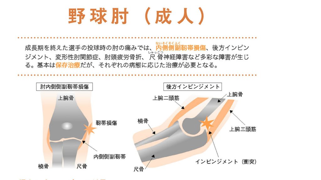 Twitter 上的 ハッスルスポケン 甲子園では熱い闘いが繰り広げられているけど 野球肘 にも注意スポ 成長期は内側が痛くなる内上顆障害が多いけど 高校生になってくると内側側副靱帯の損傷も増えてくるスポ スポーツ医学検定公式テキストから スポーツ医学