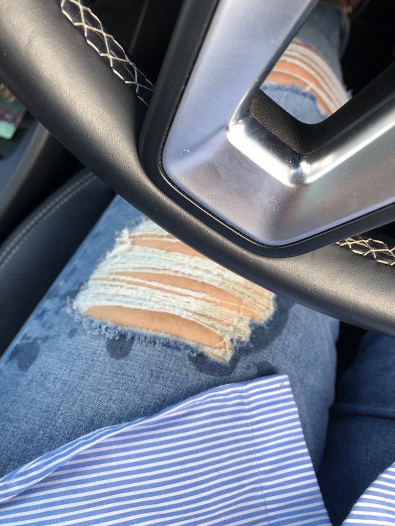 LaylaM75's tweet image. Nightmare morning.. Thanks @starbucks Lid wasn’t put on properly and burnt my leg.. Staff reply... Do you want ice???? Not a happy rabbit 😢 #servicefail