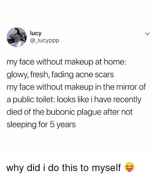 AcneForever's tweet photo. This is terrible, happens all the time :(
luckily at https://t.co/a79e4VCy9J they have easy solutions to get rid of your acne forever!
#acne #removeacne #removeacneforever #acneremedies #skincare #betterskin #clearskin #pimples #nomorepimples #cysticacne #acnescar #acnescars https://t.co/brdaI83bT2