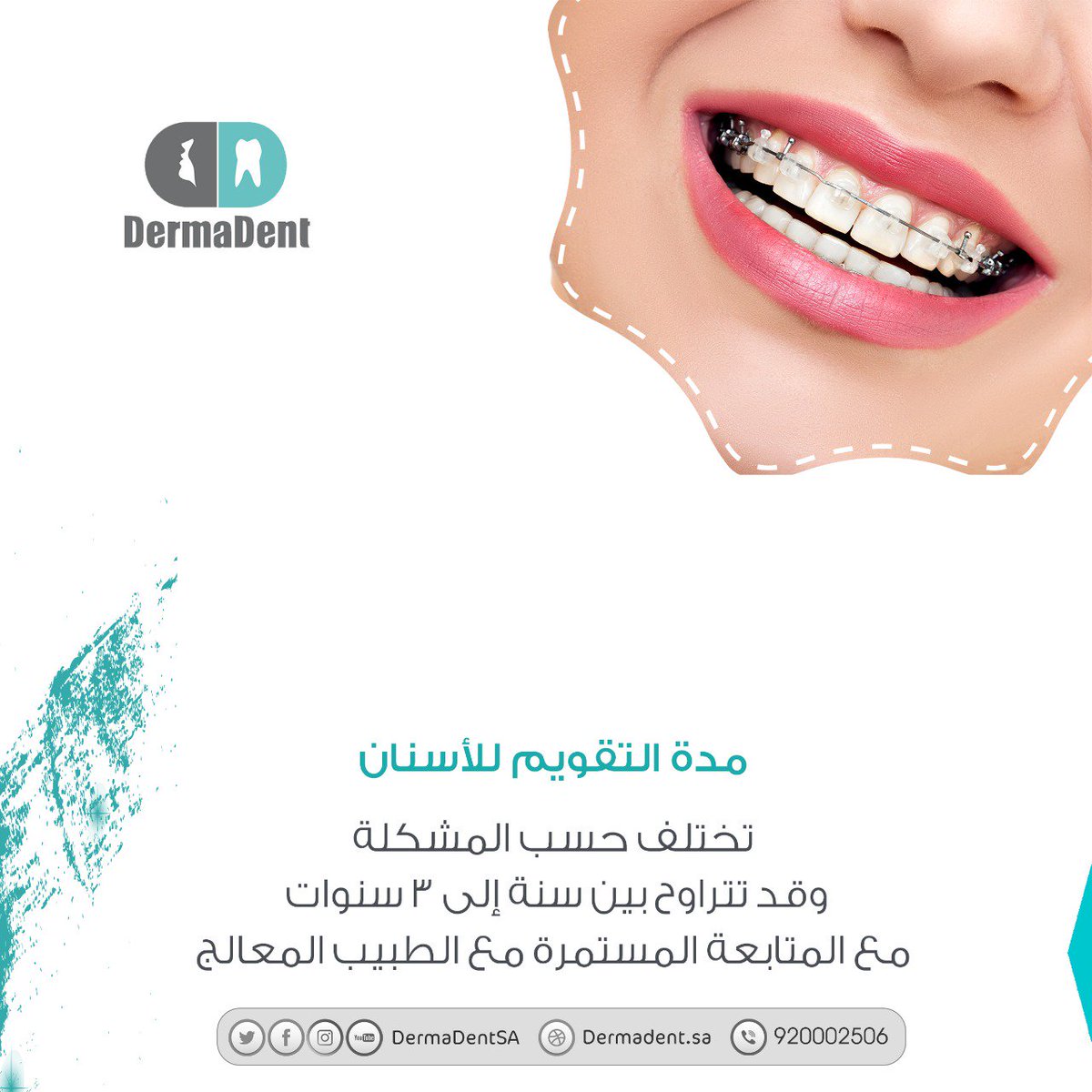 عيادات ديرمادنت على تويتر معلومات قد تهمك عن تقويم الاسنان طب اسنان تقويم الأسنان تقويم عيادات اسنان الرياض ديرمادنت طب صحة عيادة اسنان طبيب اسنان Https T Co Yyj7sqrz68