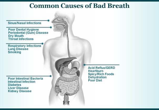 NgFundme's tweet photo. Bad breath, is characterized by an unpleasant odor of the mouth.
Causes of bad breath include food, tobacco products, poor dental hygiene, health problems, dry mouth, oral infections, dental problems, or medications
#donate #givingback #giveback #GoFundMe #fundraiser #fundraising https://t.co/78T5Vj8a5m