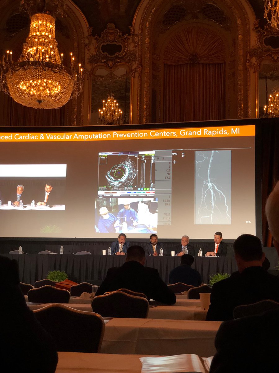 kmadass's tweet image. Great live case at #amp2018 ⁦@AMPSymposium⁩ #clifighters #myLegmyLife ⁦@SDhandMD⁩ ⁦@Watts_IR⁩ ⁦@keithppereira⁩ ⁦@SOBE_Vascular⁩ ⁦@drsavealimb⁩ ⁦@LessneVIR⁩ ⁦@ABrandisVIR⁩ ⁦@BOlivieriMD⁩ ⁦@Mustapja⁩ ⁦@FadiSaab17⁩