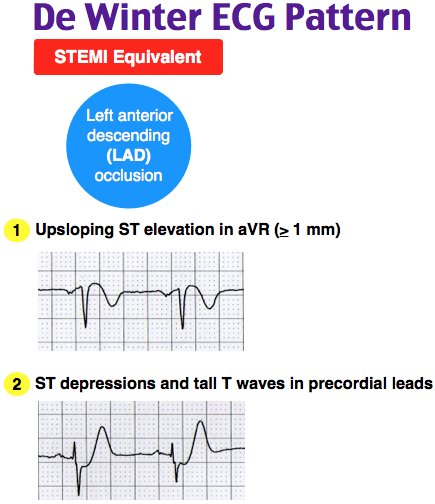 NachiGupta's tweet photo. Ep 45 of @Roshcast: ARDS, Dental Fractures, STEMI’s, Pericarditis, Bone Lesions
Lots of cardiology review...
https://t.co/CtLxgIvyvp 
https://t.co/kjhepF6RkV
#foamed https://t.co/O50hyy0Wjc