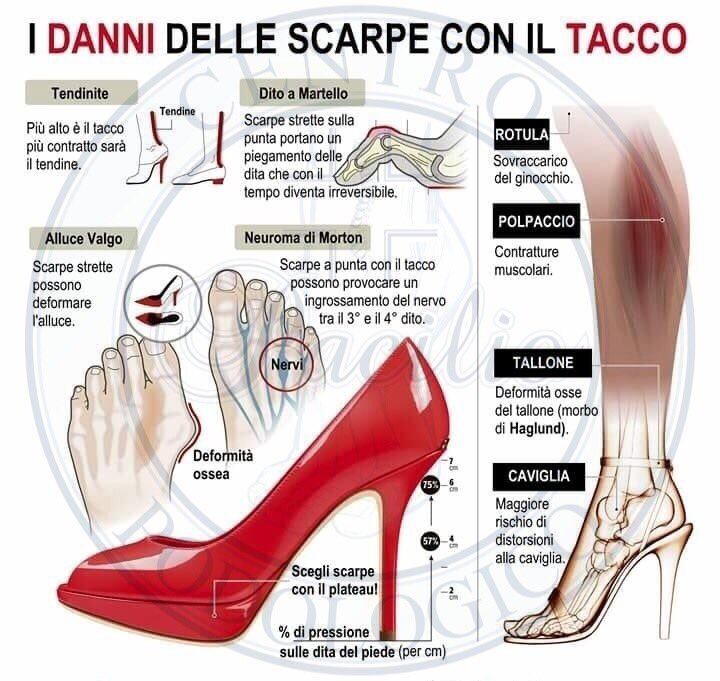 dottpacilioa's tweet photo. 📍I danni delle scarpe col tacco...parola d’ordine: “prevenzione”...#paroladeldottorpacilio #centropodologicopacilio #podiatry #podology #podoiatria #posturology #posturologo #podologo #podoposturologo #piede #postura #plantari https://t.co/HD2QCtT39f
