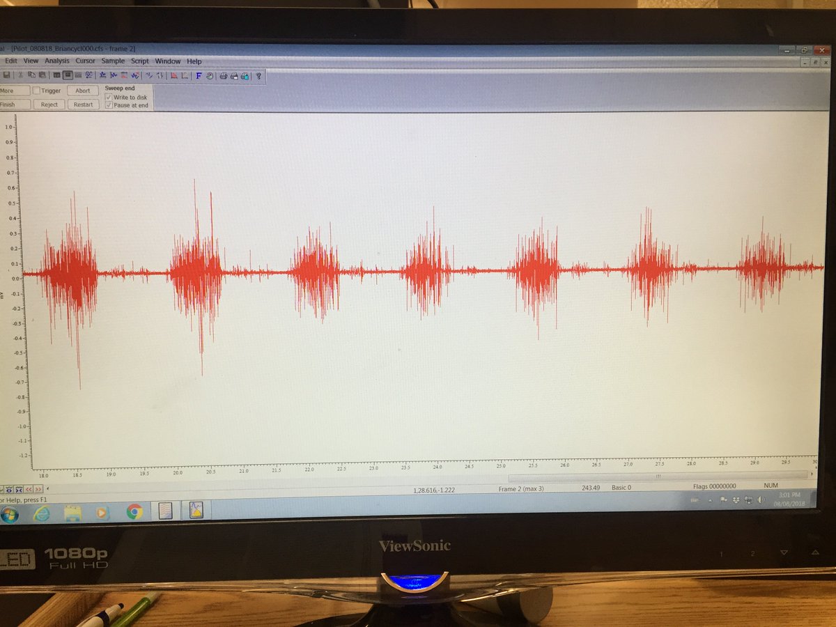 KevinPowerPhD's tweet image. Told you we&apos;d get it working! Single MU recordings from the biceps brachii during arm cycling! Still lots of work to be done, but this looks promising (and maybe just a little exciting!). @MemorialHKR @gradstudies @DaDalto81 @elocky11 #MotorUnit #Science #Research @UBC_HES