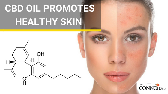 CONNOilsLLC's tweet photo. #cbdoil has also been shown to promote good skin health. Again, this benefit is partially attributed to CBD’s anti-inflammatory properties. https://t.co/28qL9P5XFH