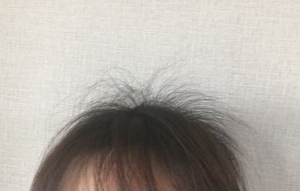 ぐうたらこ 産後のアホ毛が元気すぎて ゆきねえ状態 T Co N7uhzzmr6k Twitter ぐうたらこ 産後のアホ毛が元気すぎて ゆきねえ状態 T Co N7uhzzmr6k Twitter