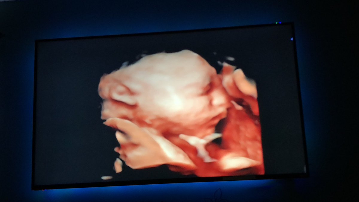 _KateElizabeth's tweet image. Cannot get over theseeeee😍💖🎀🌸 #blakelylyynmarie