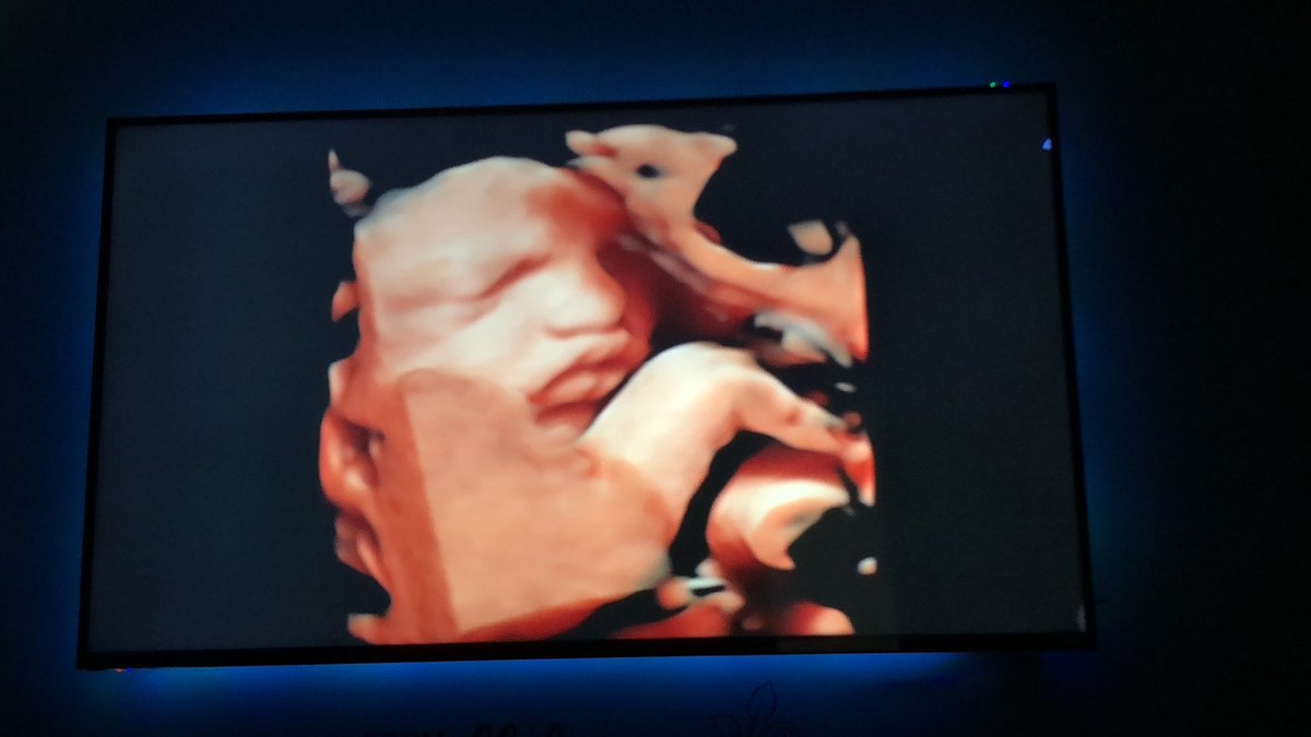 _KateElizabeth's tweet image. Cannot get over theseeeee😍💖🎀🌸 #blakelylyynmarie