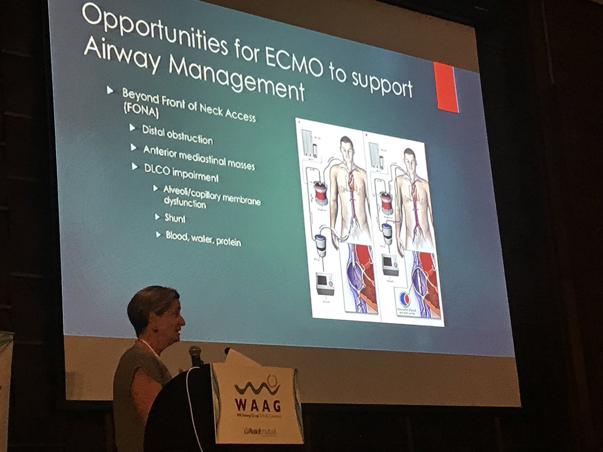 Dr Amanda Dawson <a href="/WAAGBali/">WA Airway Group</a> talking about the opportunities for ECMO to support Airway management #WAAG2018 #FOAMed