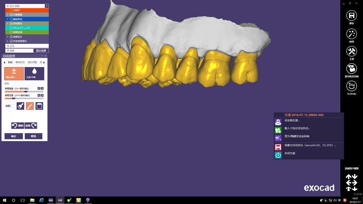 We are a dental CAD design studio, please contact me if necessary