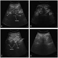 the glycaemic index cabi