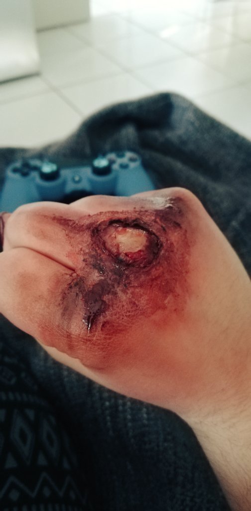 GorryNot's tweet image. Scratch burn and bone