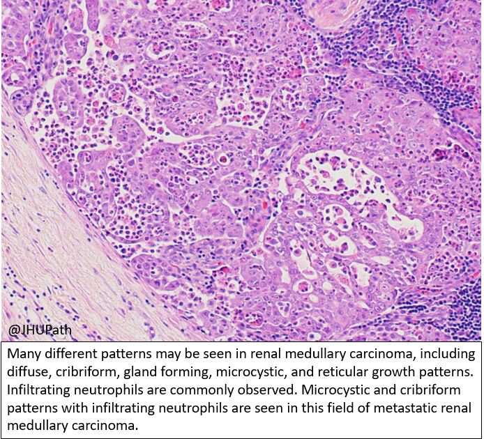 Hopkins Pathology on Twitter "Here's the answer for this