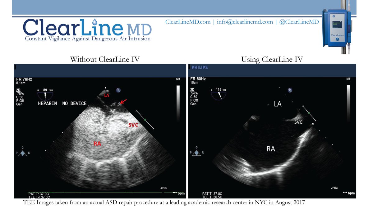 ClearLine MD tweet media