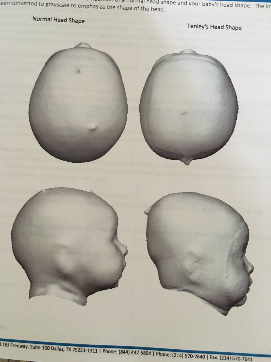 sheridanteach's tweet photo. We had the babies’ head appts today and all I could think about was the STEM technology being used to create 3D pictures!! It was so cool!! #gmsstem https://t.co/IencMXZpnx