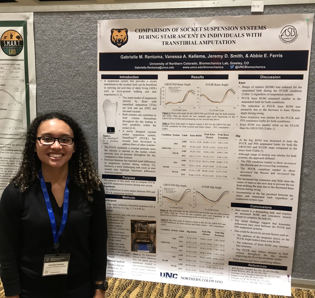 UNCBiomechanics's tweet photo. @Rentuma_GM presenting on the comparison of socket suspension systems during stair ascent in individuals with transtibial amputation #ASB2018 #ASB42 https://t.co/EauqVRfJia