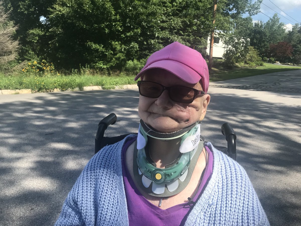 KimberlyBookman's tweet photo. Mauled by a bear in her #GrotonNH home, Apryl Rogers recounts coming face to face with the wild animal and talks about her recovery.  #7News https://t.co/VsXjWPHy4a