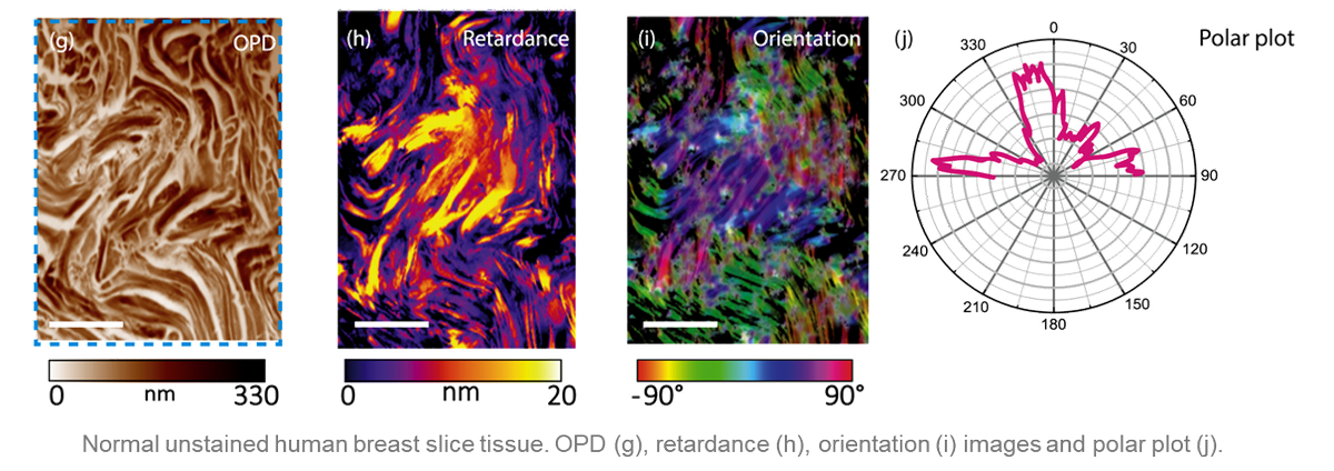 Phasics_SA's tweet image. Quantitative retardance imaging using our #WavefrontSensor: towards the detection of specific fiber organization in tissues caused by tumors development. An enthralling study of our researchers: doi.org/10.1016/j.optc…
#QuantitativePhaseImaging