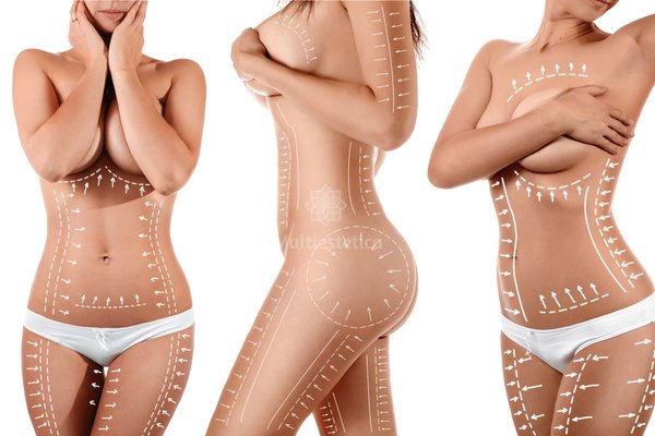 Motivos por los que se recurre a la cirugía estética
multiestetica.com/articulos/moti…