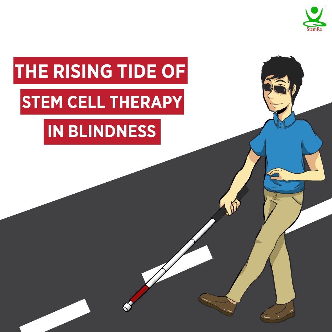 StemRX's tweet photo. Funding advances stem cell research to tackle blindness in children | Click here to read the full article: https://t.co/0D2vokXgQR 
#stemcells #therapy #treatment #blindness #research #children #recovery https://t.co/6aN3yJ7ozb