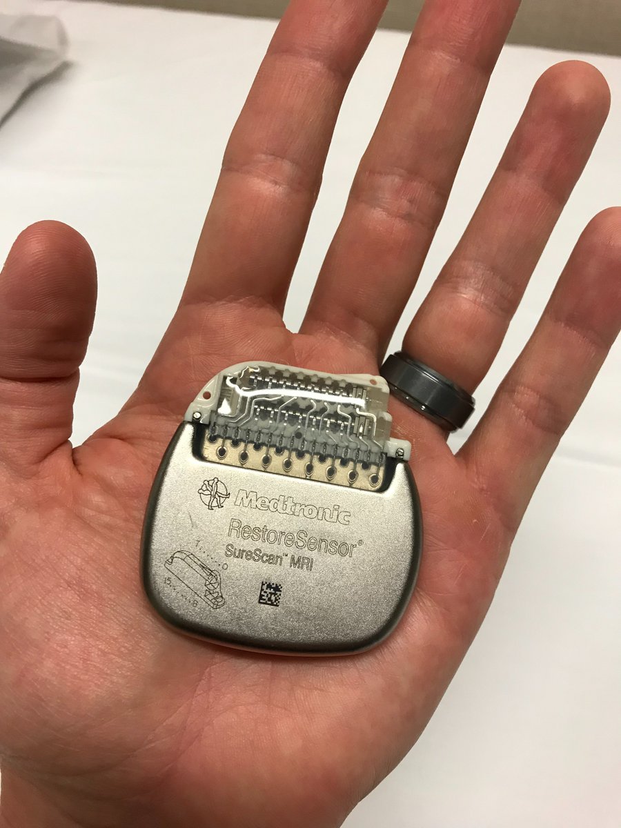 The leads are tunneled beneath the skin to the site of battery location, i.e. "the pocket". The battery is typically referred to as the  #IPG - implantable pulse generator. Each company has a unique size, shape, and characteristics.