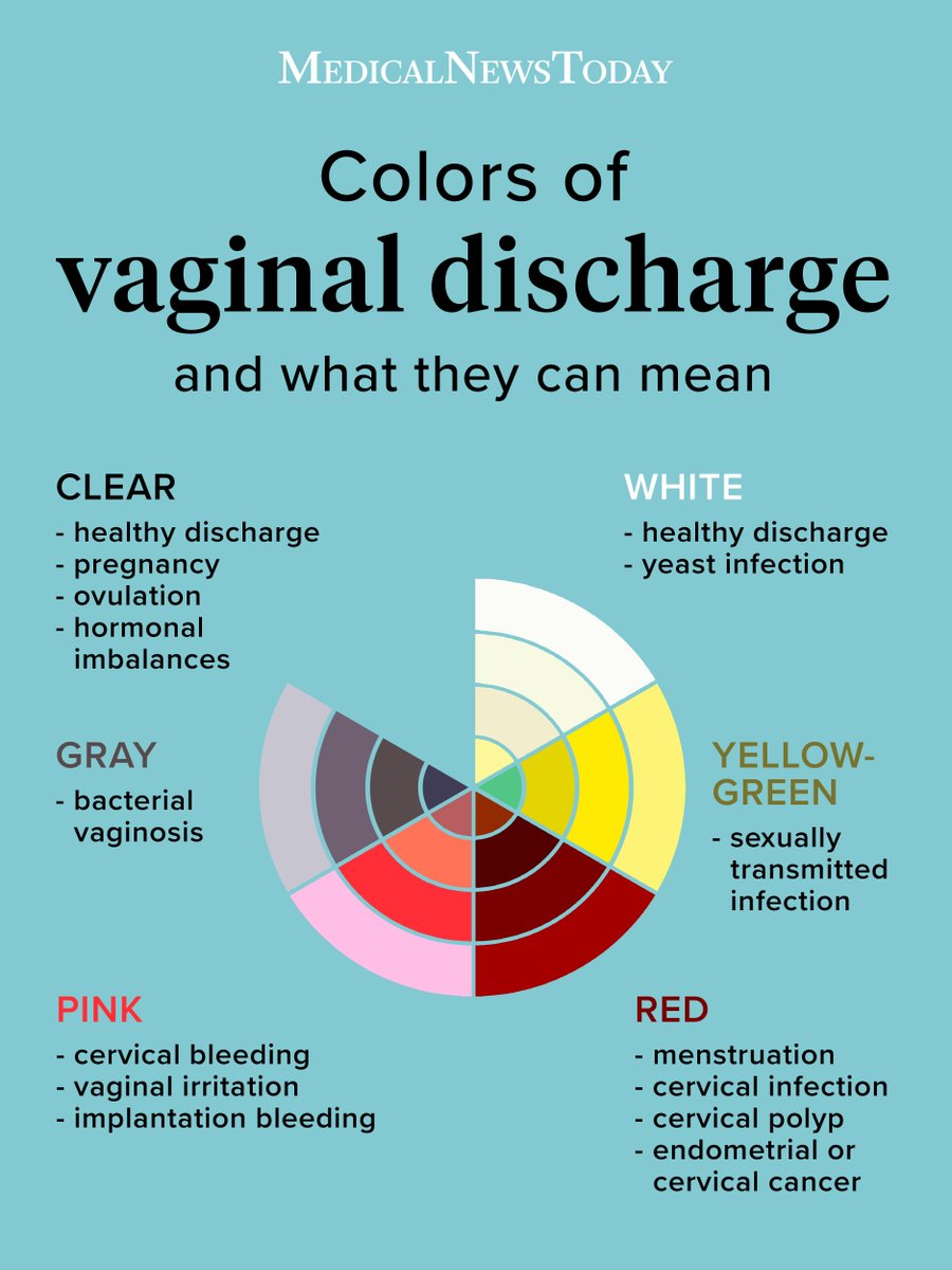 Vaginal Discharge Is Normal And Can Be Many Colors However Some Colors May Indicate Vaginal Discharge Is Normal And Can Be Many Colors However Some Colors May Indicate