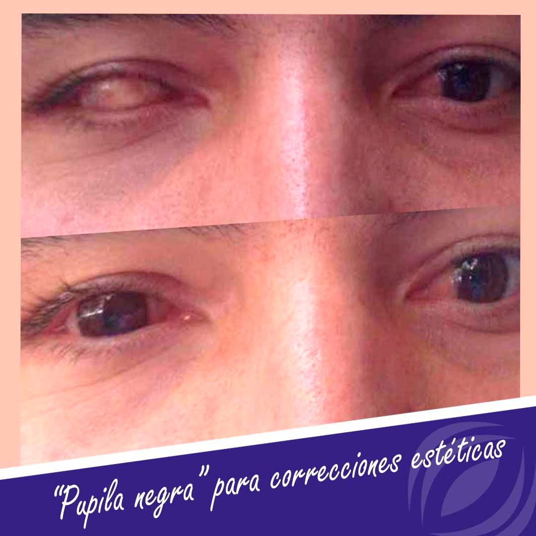 Lentes Anyday on Twitter: \