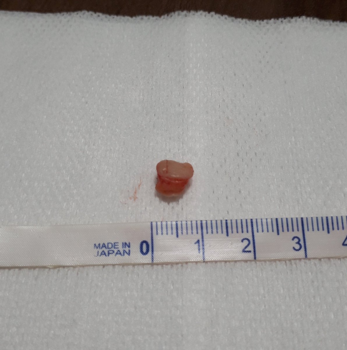 Rs ダーマルパンチ実行 耳たぶ 痛みは想像できる程度のものだが ねじりながら切るためサクッと一瞬とはいかない せっかくだから食ったが 皮が多いホルモンといったところ うまくはない ダーマルパンチ ボディピアス