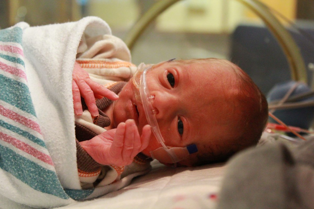 Born 11 weeks early, this child spent almost two months in the #NICU. Now he is on his way to first grade, thanks to the help of <a href="/AscensionWisc/">Ascension Wisconsin</a> and 
<a href="/GEHealthcare/">GE HealthCare</a> invent.ge/2HamvvE