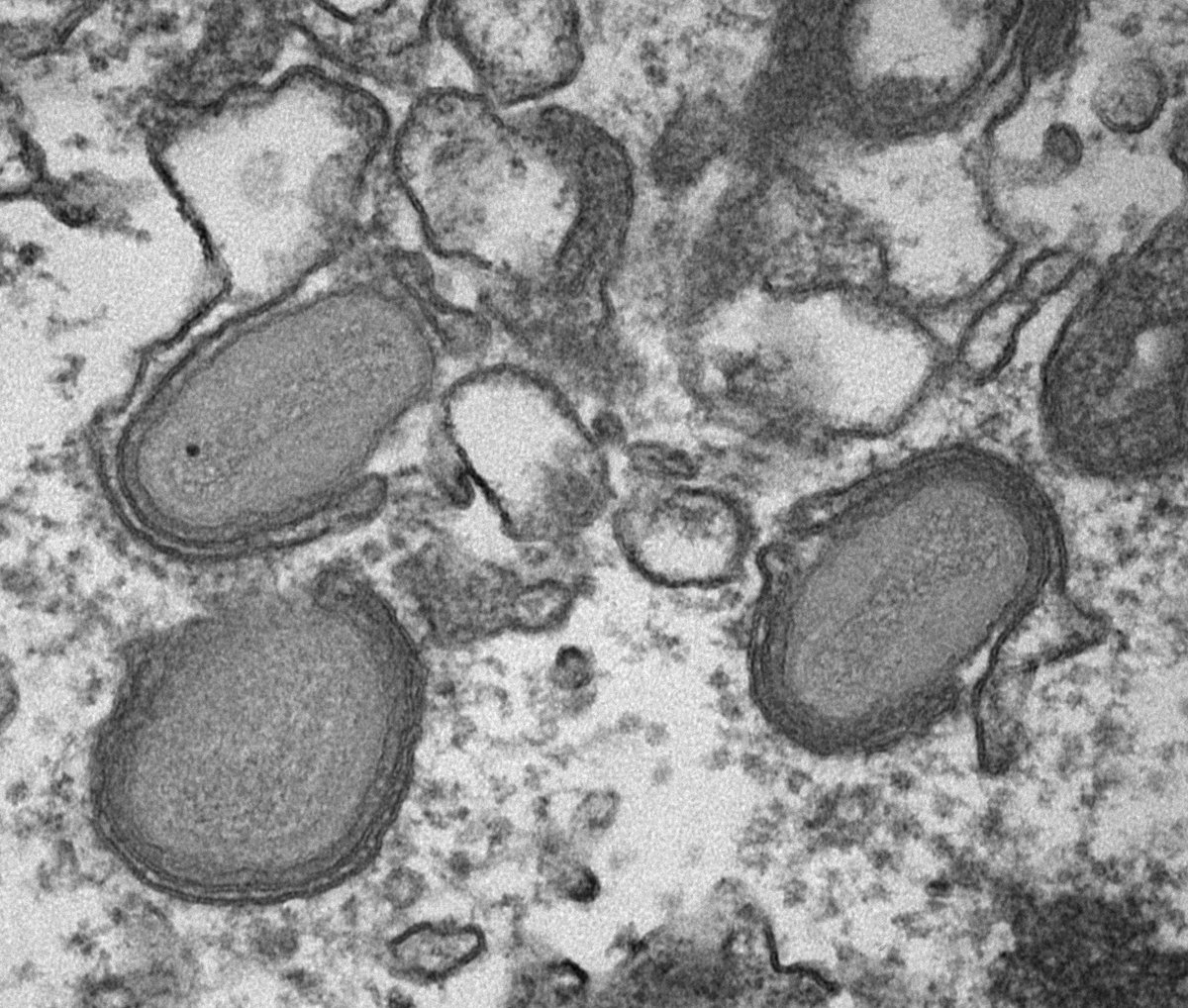 MoonaHuttunen's tweet photo. Wohoo!! Just took my 1000th EM image! @EM__Ian, watch out I'm only 53 years away! @MercerLab @MRC_LMCB #wrappingvaccinia #EMrules #Ianisthebest https://t.co/Cm3Yeo6jB7