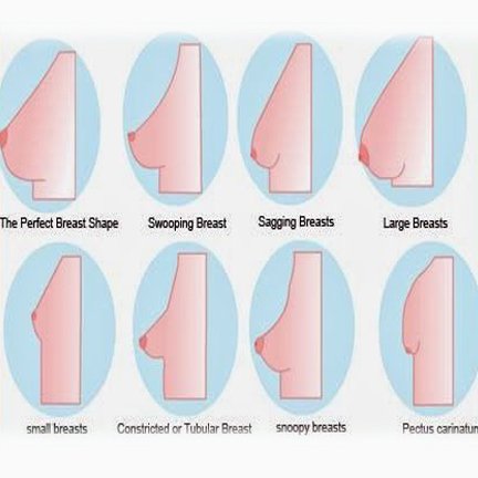 Chattering Chimps on X: Did you know your breast shape can affect