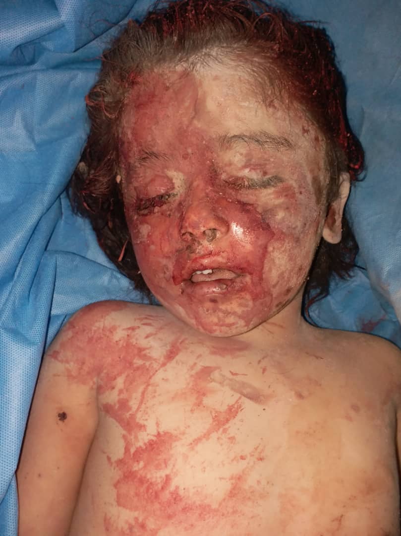 muhammadnajem20's tweet photo. They kill our children and demolish our homes and then say we want to protect you !!!
#Syria #Idlib
#Stop_terrorism_of_Assad
يقتلون أطفالنا ويهدمون بيوتنا ثم يقولون نريد حمايتكم!!!
#سوريا #ادلب 
#أوقفوا_إرهاب_الأسد https://t.co/MHCMwhTg5M