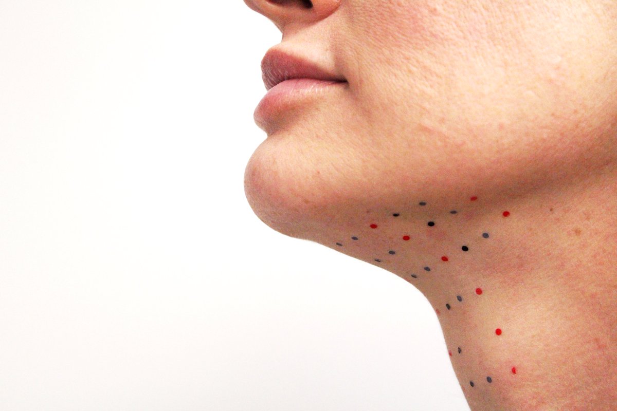 YourWellnessCen's tweet photo. Did you know there are non-surgical treatments for #looseskin? Turkey necks, wrinkly knees, flabby abs, even the dreaded #doublechin - we’ve got something for you. Read our latest blog post  to discover how you can target stubborn areas! https://t.co/YbfmhVRtzA https://t.co/JHVWZDHQ4f