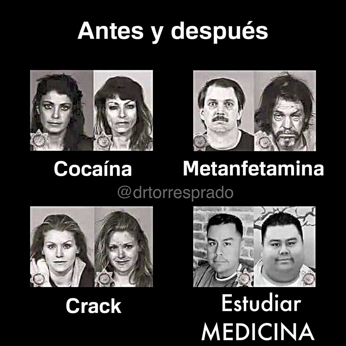 drtorresprado's tweet photo. Antes y después, ¡cuidado! 😣 https://t.co/sMgZ8sNP4b