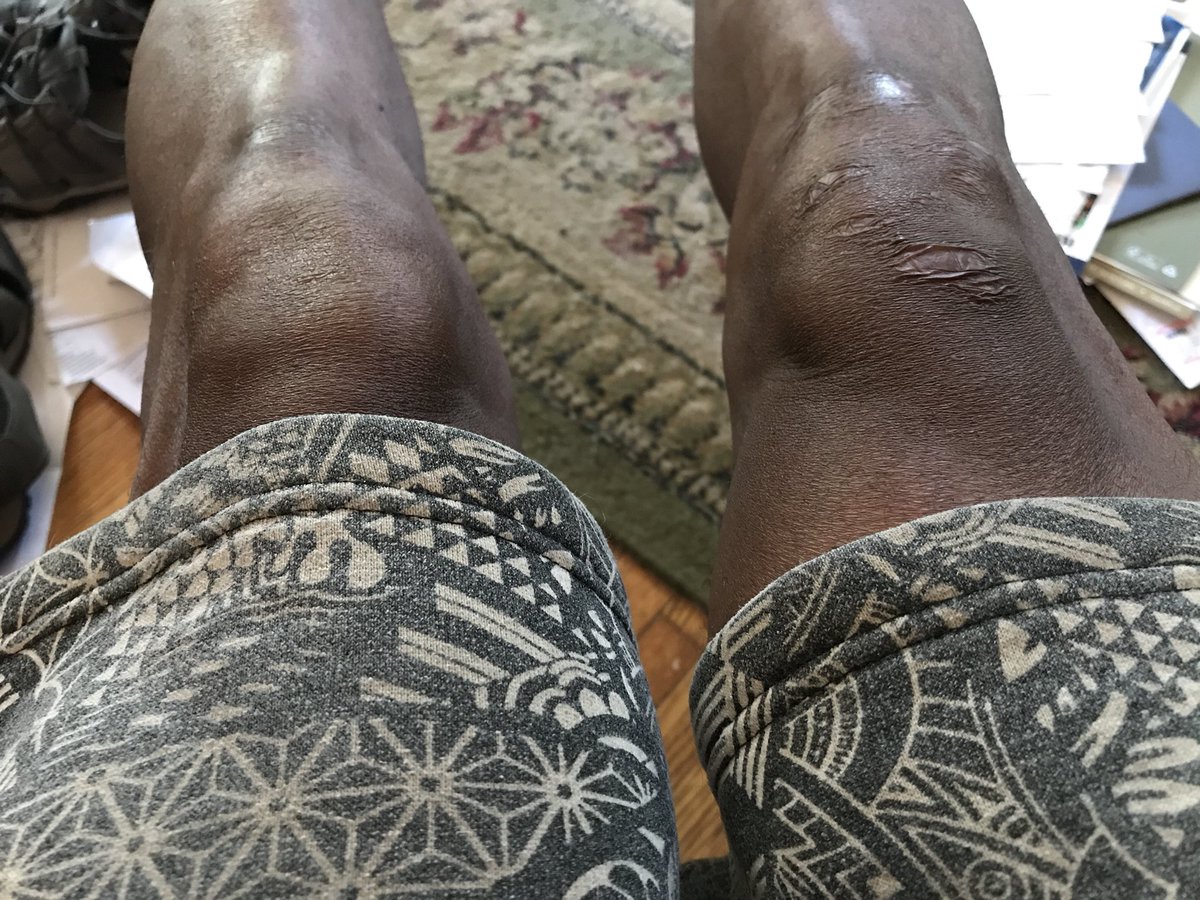 mowoodier's tweet photo. I’ve really beaten the old body up. #SelfPityTweet https://t.co/5n9T8MWnWQ