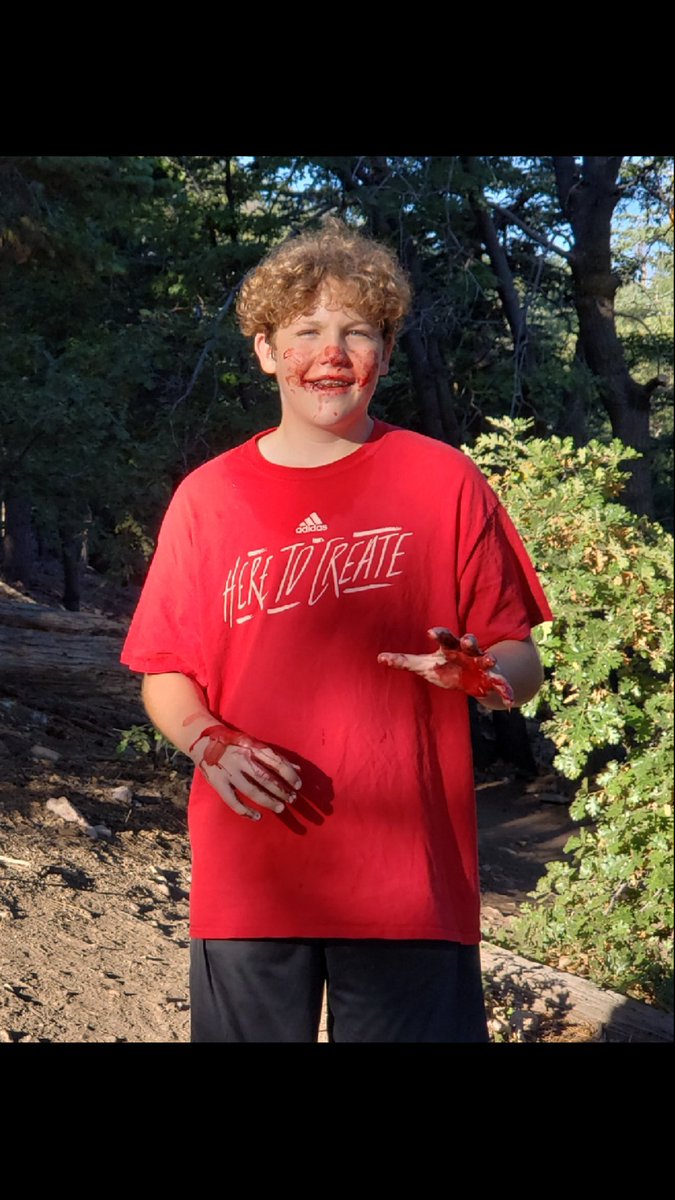 JasonDruten's tweet photo. Remember to smile...even during a bad run!  Yes...that is blood.  No, he is not a zombie. XC camp life.  If you don't love 9th grade runners we can't be friends. https://t.co/s3VhaltWc2