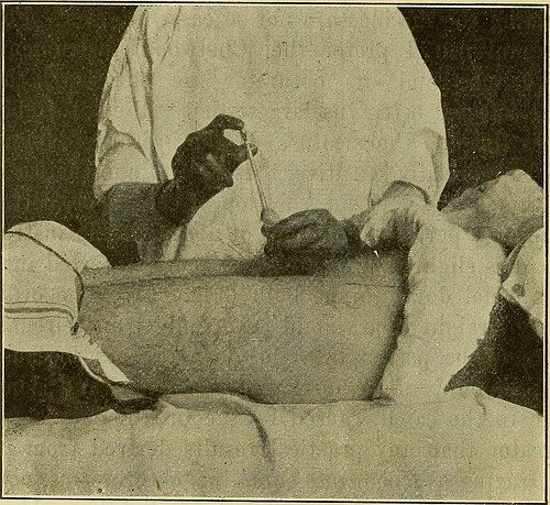 Image from page 129 of "Gonorrhea in the male : a practical guide to i...
flickr.com/photos/1263770…