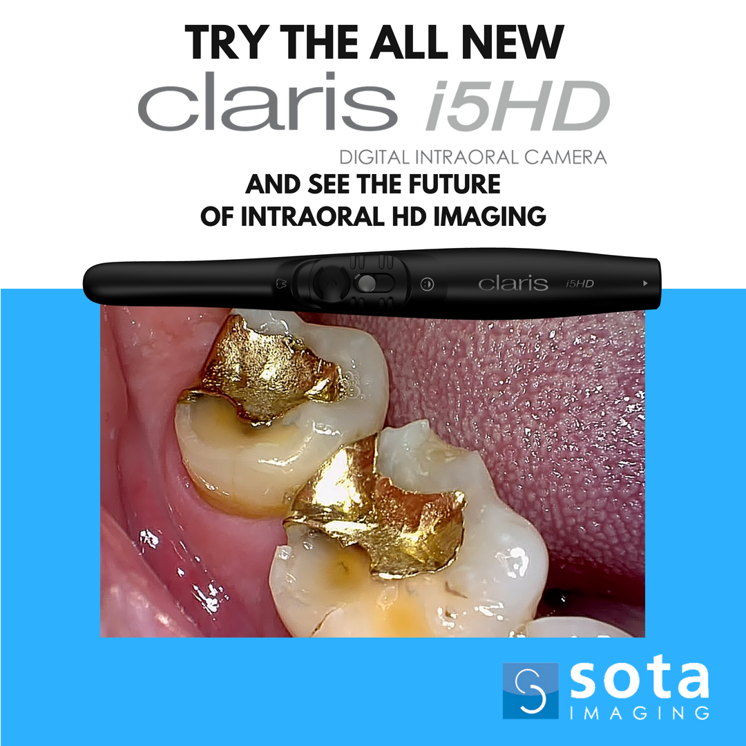 SOTAImaging's tweet photo. Prepare for the future with the incredible image quality of the brand new Claris i5HD intraoral camera. You won't believe the clarity. Get yours today!
https://t.co/f2gUw0cvEn
#sotaimaging #claris #clarisi5hd #hdimaging #dental #dentalcare #dentalhealth #dentalhygiene #teeth https://t.co/nPDkX2po7T