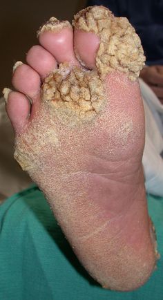 EyedFake's tweet photo. @ItsMeDeb_Again @gordy_shanks @therealdrix78 @themamibunni @suzysmiles__2 @grumpycham @QHancroft @Fuzzy_Fuzzbutt @Mookyluv2 I wonder how koko's foot rub is going. https://t.co/EtdR9qAv6p