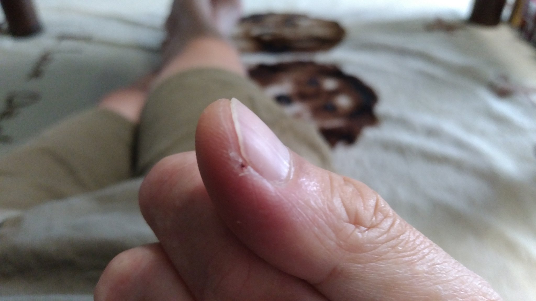 豊丸産業 未来 爪の際に刺さったトゲが抜けない 毛抜き カミソリ 針 アイテムを総動員しても抜けない チクチクと痛いんだが どうすればイイんだろう T Co Cn9uhbq3u2 Twitter 豊丸産業 未来 爪の際に刺さったトゲが抜けない 毛抜き カミソリ 針 アイテムを総動員しても抜けない チクチクと痛いんだが どうすればイイんだろう T Co Cn9uhbq3u2 Twitter