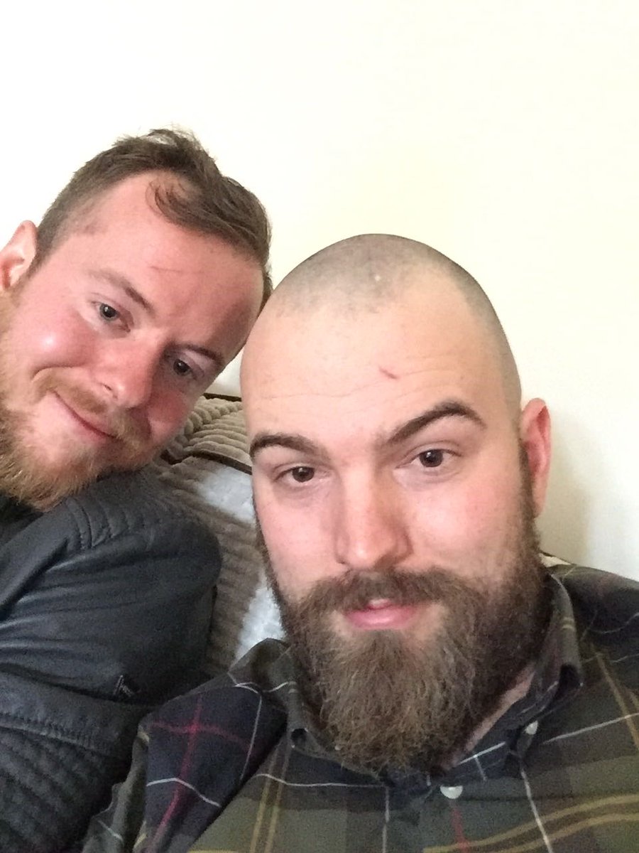 AndrewKirkham1's tweet photo. @tyson_fury my mate shaved his head. Now he looks like you. https://t.co/d9BZOH3EJV
