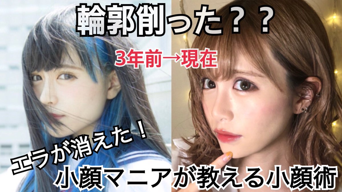 きゅっぽんのすず Twitter Da 輪郭削った 痩せた 何度されたかわからない質問について言及しています ずっと悩んで来たからこそ本気でおすすめします 顔がでかい 丸い で悩んでいる方は絶対見てください T Co 1uwm8uuzxy T Co