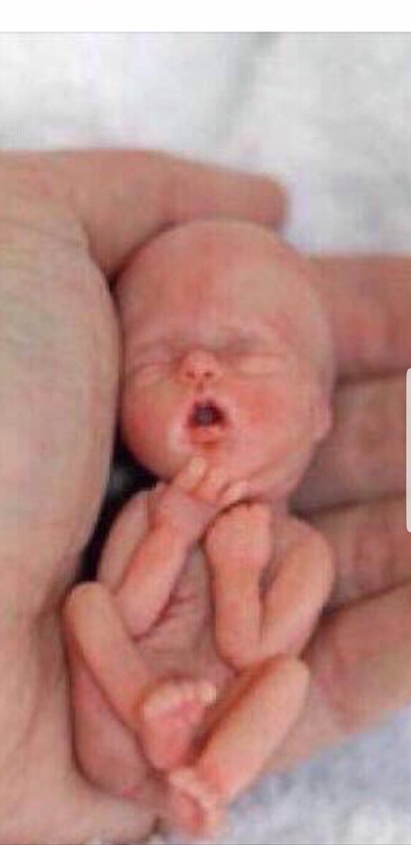 PradRachael's tweet photo. THIS IS WHAT WE ALL LOOKED LIKE AT 12 WEEKS IN THE WOMB. LEGAL TO KILL IN ALL 50 STATES. ANYONE THINK ITS NOT A PERSON???? PLEASE RETWEET IT LITERALLY MIGHT SAVE A LIFE https://t.co/Ks9F4wAnA5