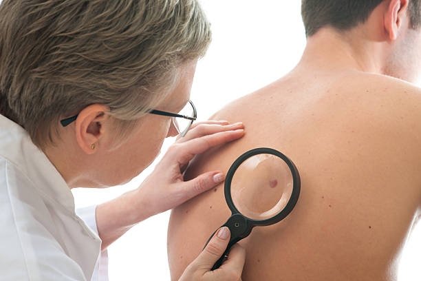DermaSpecialist's tweet photo. We treat skin cancer, rosacea, psoriasis, acne, and much more! But did you know that we can also help to improve the look of brown spots, enlarged pores, and uneven skin tone? Call us today at (952) 920-3808 to schedule an appointment for any of your skin concerns! https://t.co/HikD8H7LVd
