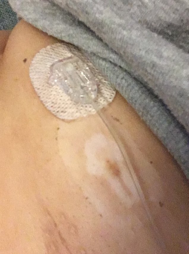 @nwamb_PTSControl tweet media