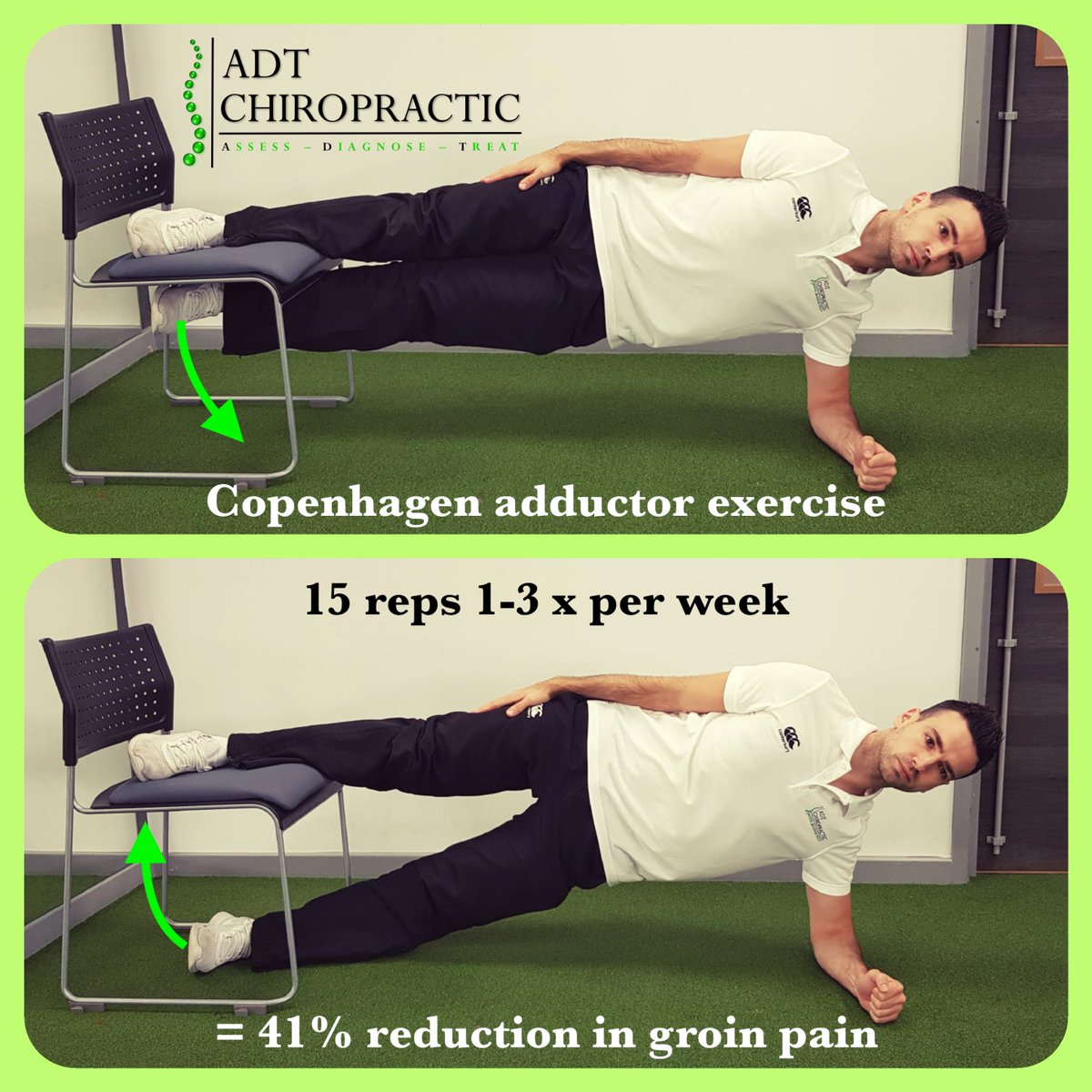 ** 41% reduction in groin pain with 1 exercise **
The Copenhagen adduction exercise reduced groin pain in semi-pro footballers by 41% by doing just 15 reps 3x per week during pre-season and 15 reps 1xper week in season! 
@GlamorganAFC @MaindyCentre bjsm.bmj.com/content/52/Sup…