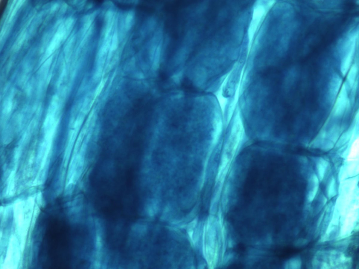MaxymReva's tweet photo. #Micorriza #arbuscular en un raíz de #melón tratado con #MYCOGEL (400, 100, 40X) - alta colonización por #arbúsculos. #WeDoBio
Arbuscular #mycorrhiza in a #melon #root treated with MYCOGEL (400, 100, 40X) - high colonization by #arbuscules. #RockYourCrops @KimitecGroup https://t.co/vGPhGNy6Lp