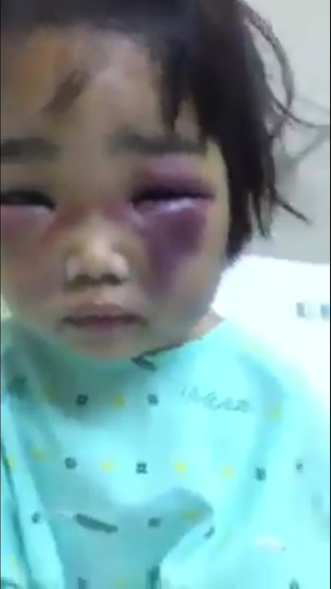beingsaifur's tweet photo. PLEASE UNTIL NOW I'M STILL CRYING FOR THIS POOR CHILD. DSWD, ANYONE WHO CAN HELP HER PLEASE❗❗❗

PLEASE RT 🙏

 @KM_Jessica_Soho #KMJS https://t.co/h9UhBOGWTD