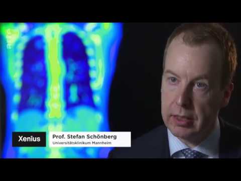 “L'homme rendu superflu par l'intelligence artificielle ?” – Reportage ... - Actu #IA actuia.com/actualite/lhom…
